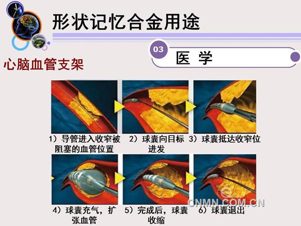 形状记忆合金