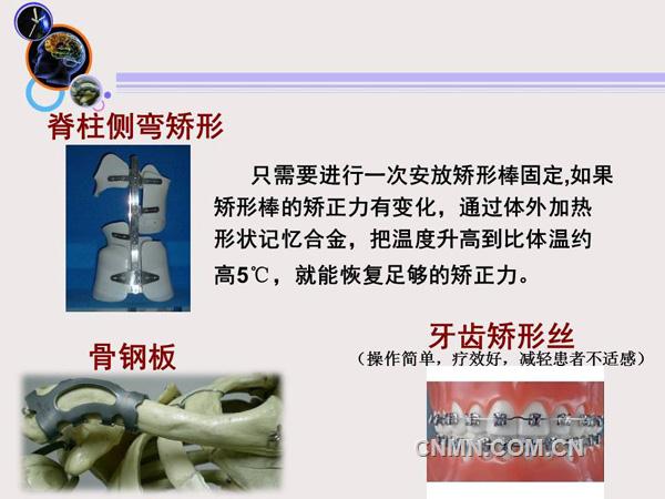 形状记忆合金新材料前沿-有色金属新闻-中色报网-中国